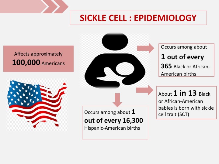 Sickle Cell Disease: Epidemiology